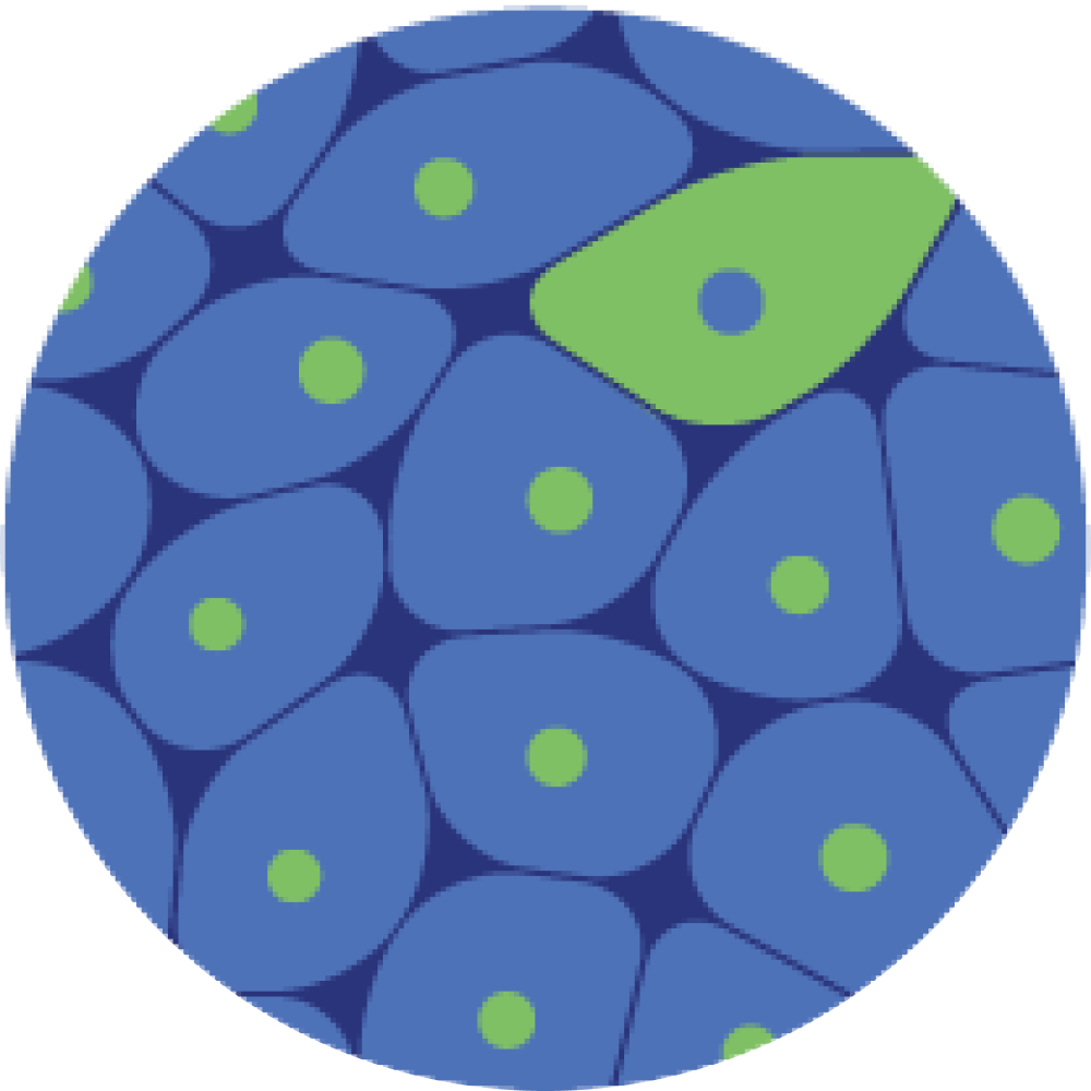 Bronchiolitis Obliterans Syndrome Airway scRNA-Seq Analysis - Overview ...